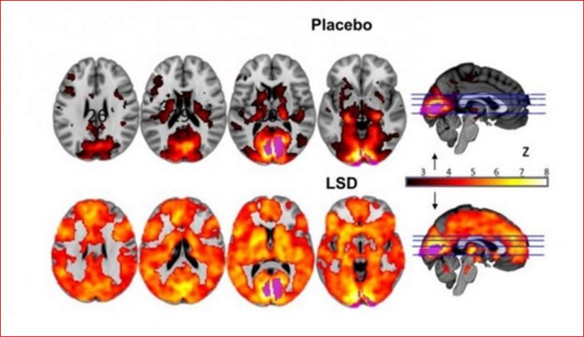 placebo.JPG